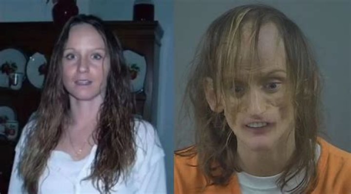 Misty Lowman's Inspiring Path: From Viral Moment to Lasting Recovery